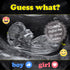 Pregnancy announcement social media guess gender